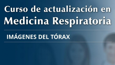 Imagenes del tórax Curso de avances del último año en medicina respiratoria de la AAMR